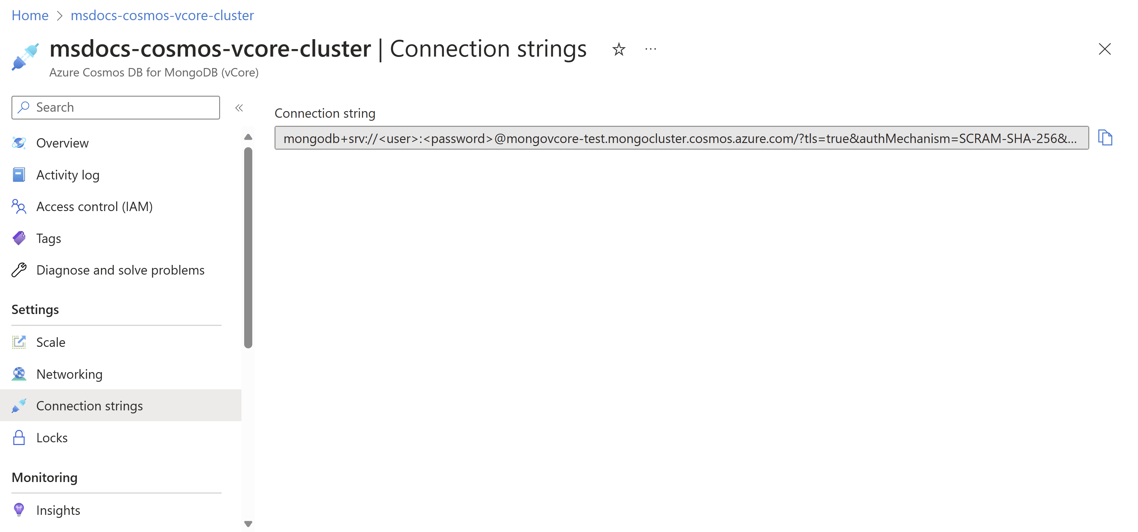 Screenshot del pannello per le stringhe di connessione.